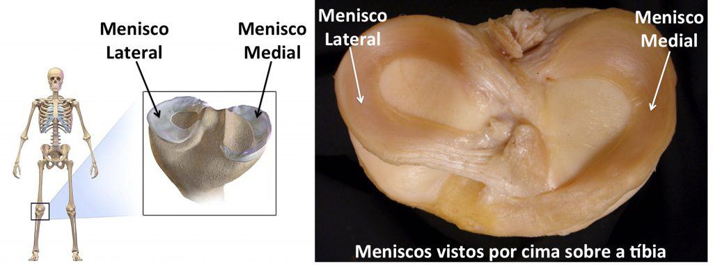 Menisco Lateral e Medial visto por cima sobre a tÃ­bia